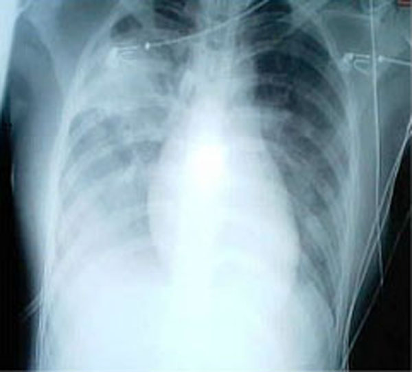 Uploaded medical image (scan)